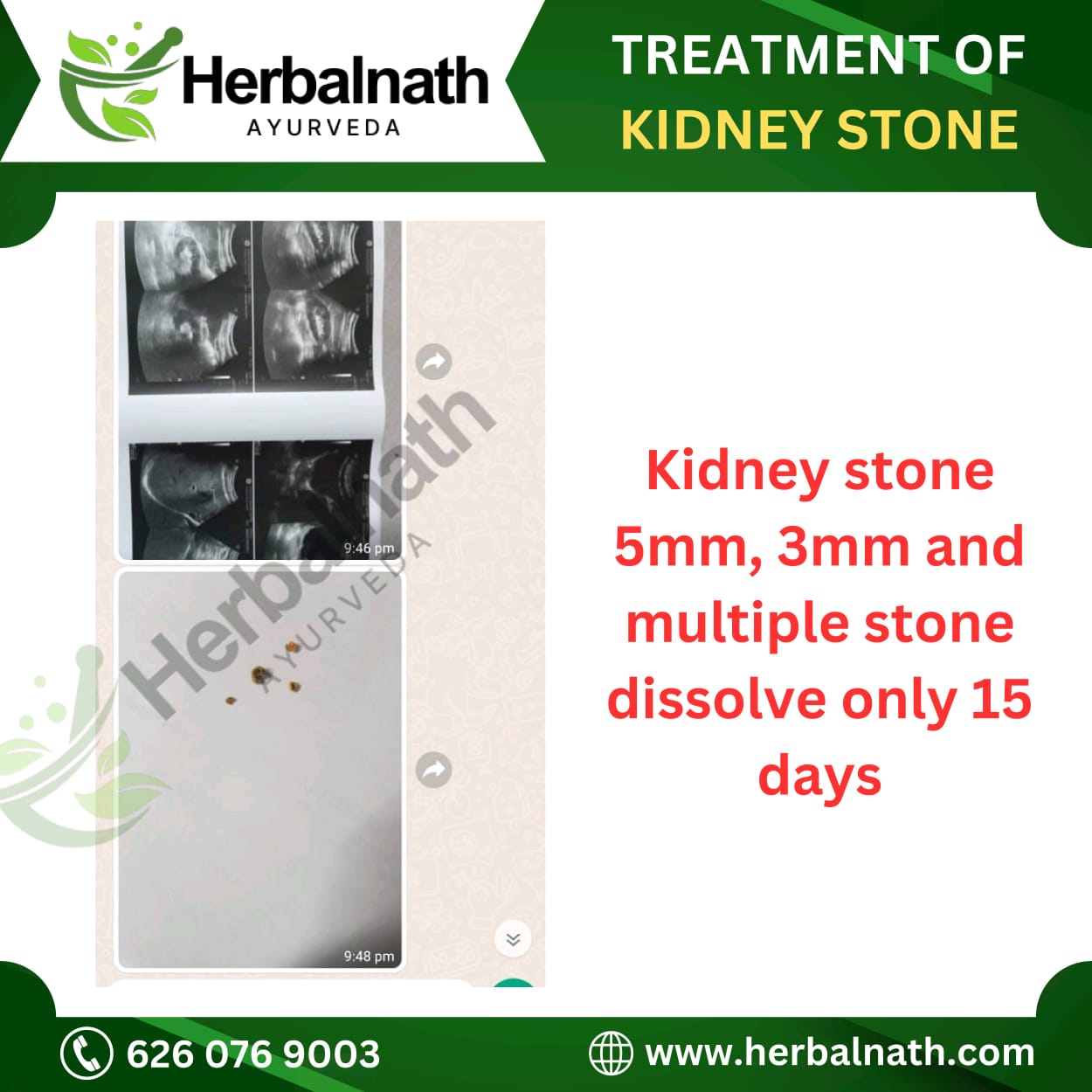 WhatsApp Image 2025-01-13 at 12.55.17_16348512